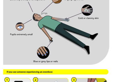Signs of an Opioid Overdose • Breathing is slow or has stopped • Extremely drowsy or unresponsive grrrrgh Pupils extremely small Blue or grey lips or nails If you see someone experiencing an overdose: HEALTH DEPARTMENT Foaming at the mouth or gurgling sounds 1 911 Call 91 1 immediately 2 Administer Narcan/Naloxone Cold or clammy skin 3 Start rescue breathing or CPR if necessary