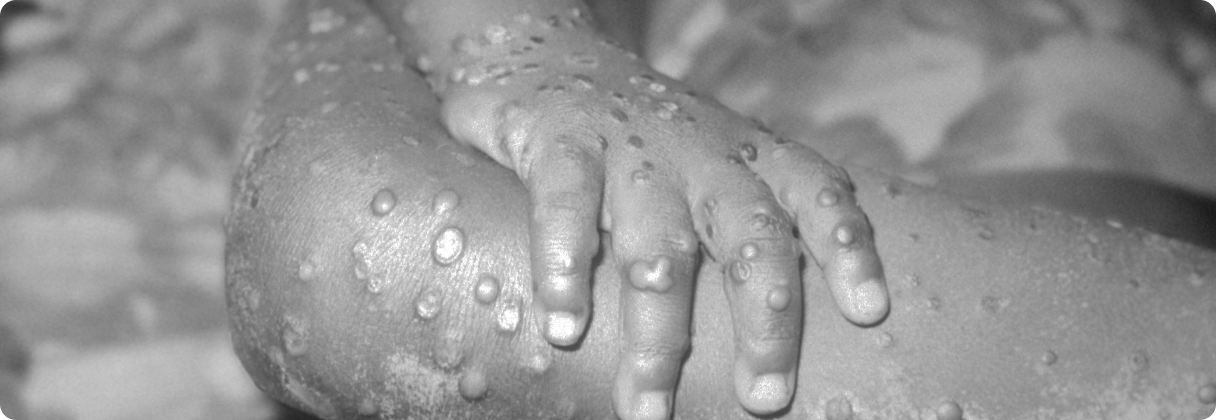 A close-up of a person's foot.